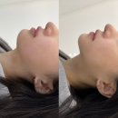 은계동물병원 | 시흥 웨딩관리 잘하는 곳 리프팅 추천 세레누 피부 &amp; 왁싱 얼굴 이중턱 지방 없앤 솔직 후기