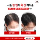 부산두피문신을 검색하고 계신 분들이라면 꼭 확인하셔야 해요