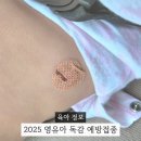 알레르기 | 2025 영유아 독감 예방접종 시기 접종열과 알레르기 반응 후기