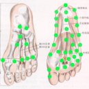 발. 발바닥통증(족저근막염) 이미지