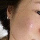 리멤버피부과의원 동탄점 이미지