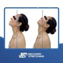 리커버리 스트레칭 이미지