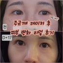 벨포인트의원 네이버블로그