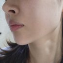 바노바기피부과의원 | 대전바노바기 볼뉴머 둔산동 피부과 솔직후기