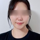 그린필 | 보습과 재생을 한번에 하는 올인원 필링 전주 오른에스테틱 그린필 후기