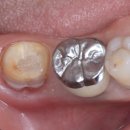 어썸치과기공소 이미지