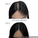 에스엠 DM | 인천 두피페인팅, 가르마 두피문신 전문샵 찐후기!