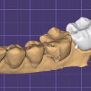 지안치과기공소 이미지