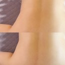 등이 뻐근해서 다녀온 이천피부샵 라인뷰티 관리 후기