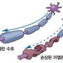 경화 티스토리