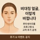 아우룸 | 루미네아우룸 비대칭 관리, 이렇게 진행됩니다 - 후기 &amp; 이벤트