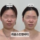 인동32길-2 | 힐링 테라피로 윤곽 관리 구미에스테틱 리윤스킨앤바디 후기 인동에스테틱 추천