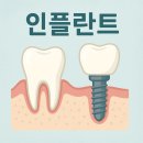 건강플러스 요가 C | “인플란트, 잃어버린 치아를 되찾는 과학”
