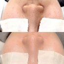 월영동293 | 마산피부관리 댓거리여드름케어는 제이클래스뷰티에서!