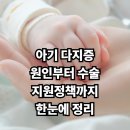 아산사회복지재단 보성아산병원 | 다지증, 아기 손가락이 하나 더? 원인부터 수술·지원까지 완벽 정리