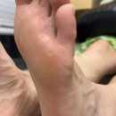 인하우스 | 대연동 발각질관리 반디네일 반디인하우스 대연 솔직후기