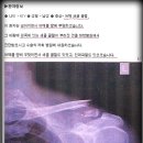 허위진단서 행사 4시10분 X-ray 언제든지 같이가서 판독열람하자 이미지