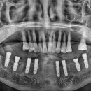 서산치과기공소 이미지