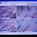 두석빌딩 | 안산두피관리 두피 가려움 깔끔하게 해결한 모엘두피탈모센터 후기