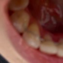 죽전 에스라인치과의원 이미지