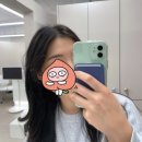 제이원병원 | 제이원브로우 지원 대표원장님 자연눈썹 속눈썹펌 시술후기