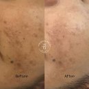 아마란스 어린이집 | 피부관리 꿈에스테틱 광주 서구 쌍촌동 가격위치주소이벤트할인 총정리
