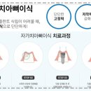 화이트치과기공소 이미지