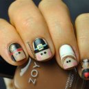 Moon nail