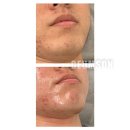 소답동197 | 창원왁싱 창원인중왁싱 &amp; 창원턱왁싱 잘하는👍 창원슈가링왁싱전문🏅 창원금손언니왁싱🥰