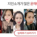윤헤어라인의원