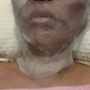 타이피분 | 명동에스테틱 난다타이아로마 명동점 피부관리 후기