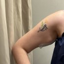 바스멍 | [웨딩 관리] 유라인클리닉 지방분해주사 팔뚝컷주사 2회차 후기