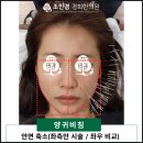 양귀비한의원 네이버블로그