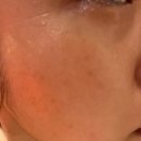 엔젤뷰티 | 압구정 화이트태닝 후기💡 ‘뷰티엔젤 CVT32’ 5회 체험! 텐몬스터 압구정점 방문기