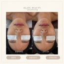 상남동186 | 지인추천 많은 김해 피부관리실 블랑뷰티