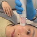 4 | 부산 경성대피부과 김나영볼뉴머 300샷 4주후기