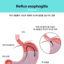 청운한의원 네이버블로그