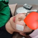 중림한의원 | [펄피치 리프팅] 리프팅 끝판왕 실리프팅 2회차 솔직 후기 사진, 아픈가요?, 여행사진들