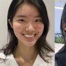 더 예쁨 이미지