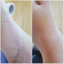 아이풋네일 이미지