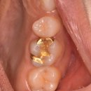 애플치과기공소 이미지