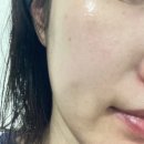 레이저후재생크림 사용 후 피부진정 된 후기..ㅎㅎㅎ- (메디스유 시카크림)
