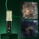 주식회사 큰나무약품 | 현대약품 마이녹셀 스칼프 인텐시브 탈모앰플 60ml 3개 세트 집중 두피 영양