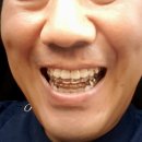 명인치과기공소 이미지