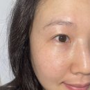 정선희 | 정선희기미팩 한 달 솔직후기 샤르드멜라필크림 쓰고 기미 옅어짐