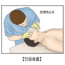 일산화탄소 중독 Carbon monoxide-poisoning 이미지