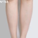 청담역에스테틱 웰니스온도청담 내돈내산 림프리커버리 90분 받고 온 후기