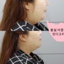 연세미니성형외과