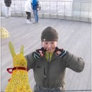 좁은 이마 필러 후기