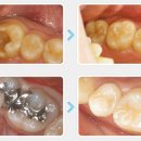 예담치과기공소 이미지